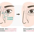 警惕！黑眼圈不僅是睡眠不足，還有可能是腎病來襲！