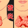 忽視這7種「小病」易發生癌變！晚知道後悔一輩子！！