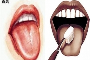 清舌苔能防癌，但不能用錯方法！刷牙時謹記「這幾招」讓你病痛不入口！