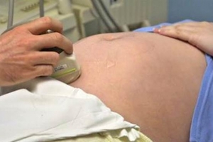她墮胎完月經還是沒來，後來肚子竟越來越大！自行驗孕15次都顯示有喜!?