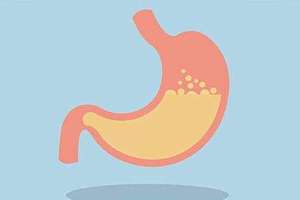 慢性胃炎該如何調理？慢性胃炎的中醫調理法