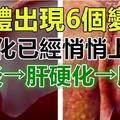 身體出現6個變化，「肝硬化」已經悄悄上身了！肝癌不痛不癢，發現已經是晚期，早期癥兆要注意！     ※※※※ 歡迎分享出...