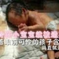 女子路邊發現一個嬰兒，送去醫院檢查後，醫生含淚道：父母作孽呀