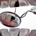 牙齒比較常見的疾病有哪些？