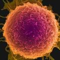 癌細胞「討厭」的9種鹼性食物，別捨不得吃，為防癌助力
