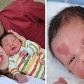小嬰兒一出生就頂著「愛心胎記」降臨！7年後長大「更可愛的樣子」已經萌爆一票粉絲了