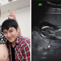 44歲葉家妤「宣布懷上第3胎」　與妹妹白家綺抱著哭