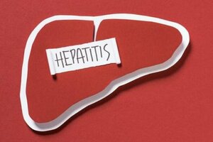 肝炎早期表現是什麼？