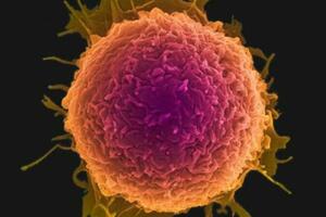 癌細胞「討厭」的9種鹼性食物，別捨不得吃，為防癌助力