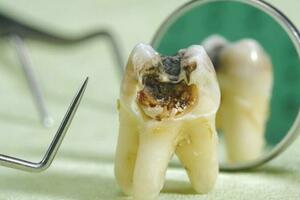 牙齒越少，死得越早？60歲後，牙齒剩多少顆才正常？看看你合格沒