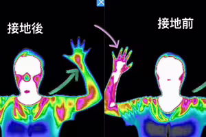沒吃藥！長期手痛「1動作」減少發炎　半小時效果醫驚喜