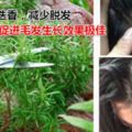 醫生直言：這4種洗發水別再買回家，號稱頭皮死敵，商家根本不用