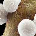 癌症放化療骨髓抑制，白細胞、血小板減少，醫生分享7個食療方
