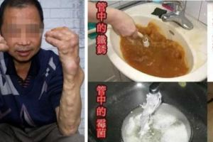 肝癌的「隱形殺手」，每一家都有，使用前一定要多看看